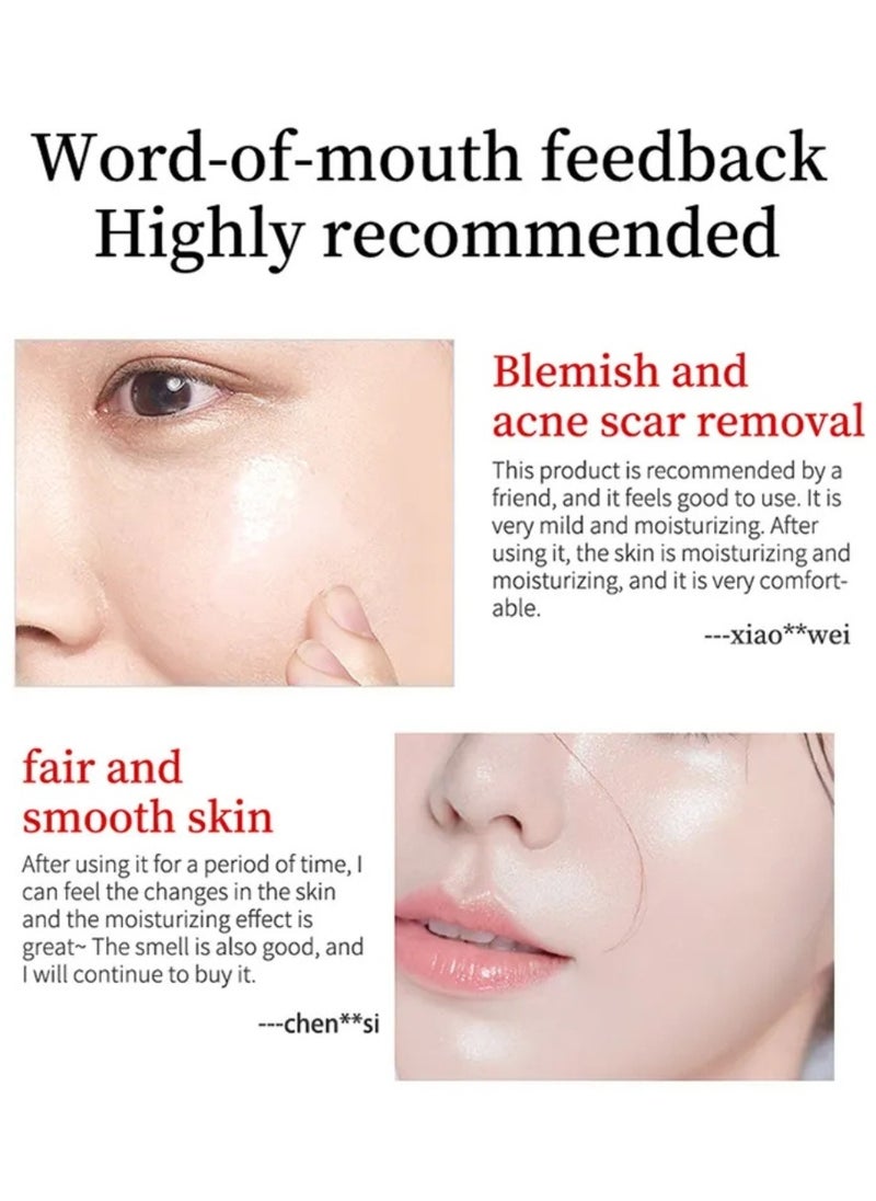 YOUBUY - Whitening Blemish Cream Whitening and Freckle Removing Cream Dark Spot Remover for Face Fade Fine Lines and Melasma Freckle Remover Hyperpigmentation Care Dark Circle Removing Essence 20g - Image 1