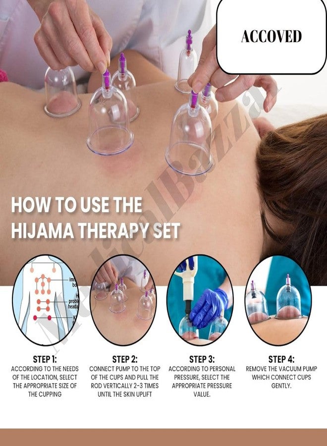 ACCOVED Medical Bazaar Cupping Therapy Cups | Hijama Cupping Set (Size 0-6) | Loose Cups for Professional Cupping Therapy|Pain Relief |Massage| Detox Therapy (S0-7CM(Set of 10Pcs)) - Image 4