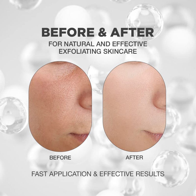 Proot AHA BHA Exfoliant | AHA BHA Exfoliant for Face | AHA BHA Peeling Solution for Face | AHA BHA Exfoliating Serum with High Concentrate of Salicylic Acid, Glycolic Acid and Hyaluronic Acid | AHA BHA Exfoliant for Face with Natural and Innovative Skin Rejuvenating Complex | Exfoliate for Face with AHA & BHA Concentrate | AHA BHA Exfoliant for All Skin Type | Facial Exfoliator with Natural Ingredients | 1.69 fl oz 50 ml - Image 2