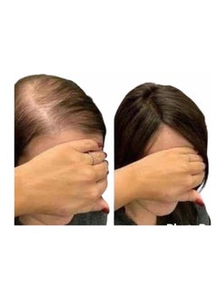 Oilex Oil Garlic ampoules to treat hair loss 5 ampoules from oilex oil  - Image 3