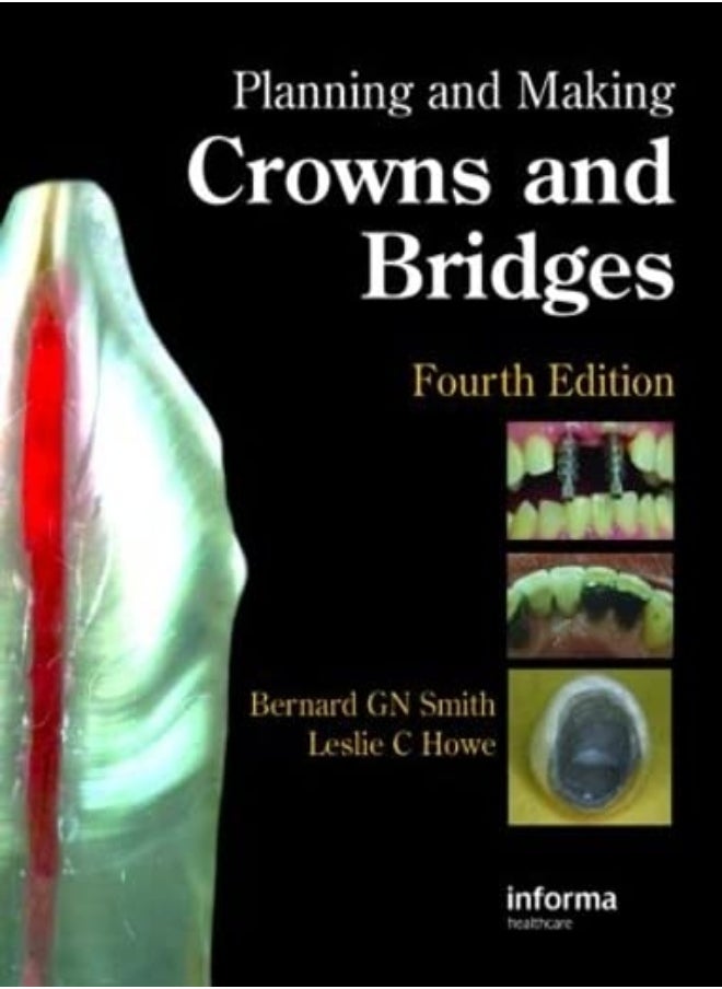 Planning and Making Crowns and Bridges - pzsku/ZDD37E755546F961FD54CZ/45/_/1695819609/708fc05d-df5a-45e5-bc3b-ada112aa02f4