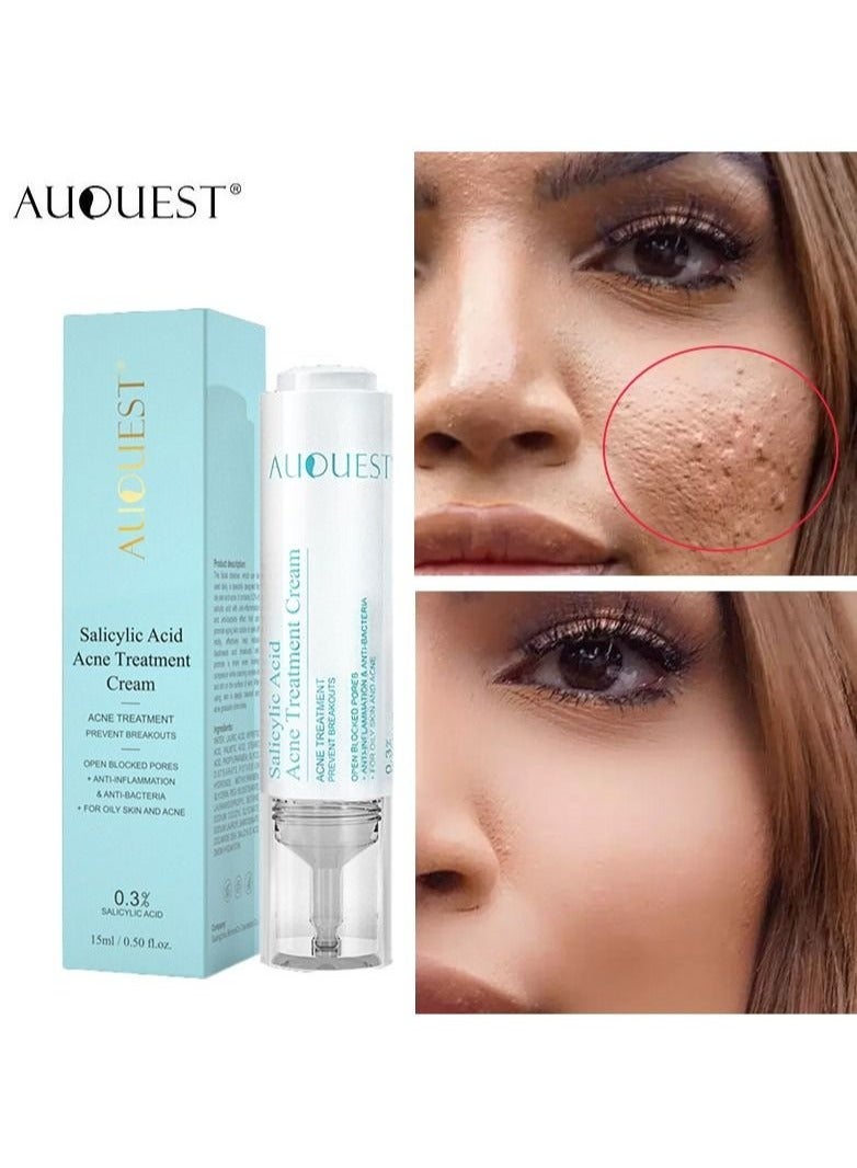 AuQuest Salicylic Acid Acne Face Cream Whitening Facial Treatment Hyaluronic Acid Black Dots Remove Skin Care Beauty Health - Image 1