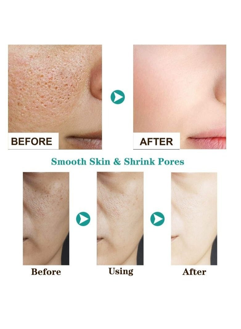 AuQuest Salicylic Acid Acne Face Cream Whitening Facial Treatment Hyaluronic Acid Black Dots Remove Skin Care Beauty Health - Image 4