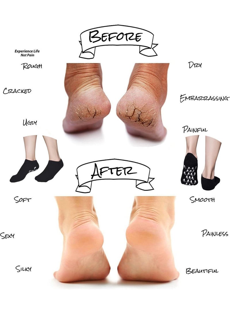 Meetion جوارب مرطبة (مقاس رجال)، جوارب جل لإصلاح البشرة الجافة المتشققة، جوارب سبا جل لإصلاح وتنعيم بشرة القدمين الجافة المتشققة، بطانة جل مشبعة بالزيوت الأساسية والفيتامينات (2 زوج)  - Image 4