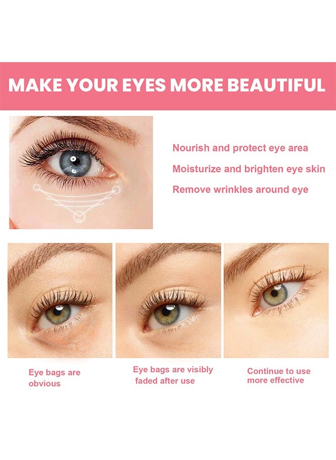 West&Month Rosehip Eye Balm,Rose Fruit Eye Cream Stick, Moisturizing And Moisturizing Around The Eyes, Reducing Wrinkles And Dark Circles,De-Puffing,Brightening,Repairing And Lifting And Tightening Eye Cream  - Image 4