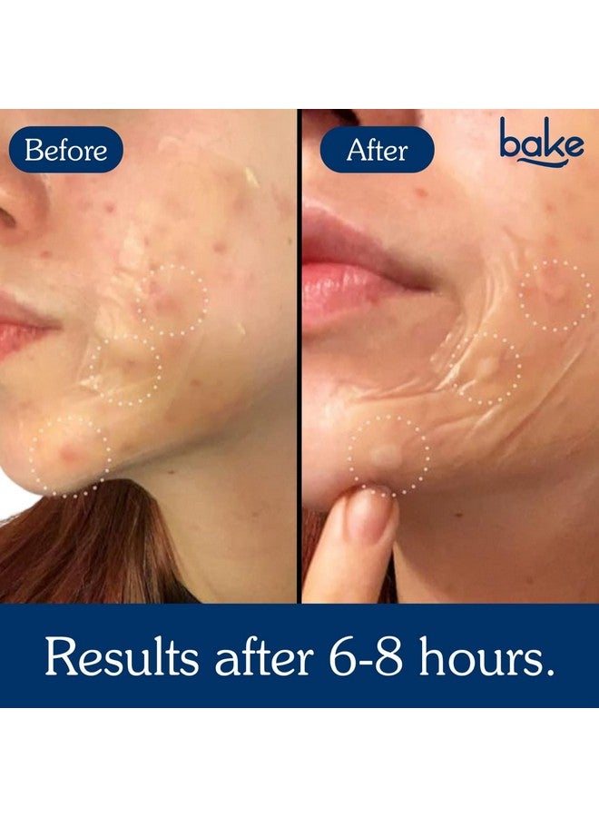 BAKE 2% Salicylic Acid Hydrocolloid Acne Absorbing (10 Patches) Surface Patch XL Pimple Patches for Blackheads Removal | Large Acne Erase Strips | Pore Cleansing & Reduces Whiteheads (10 Strips) - Image 4