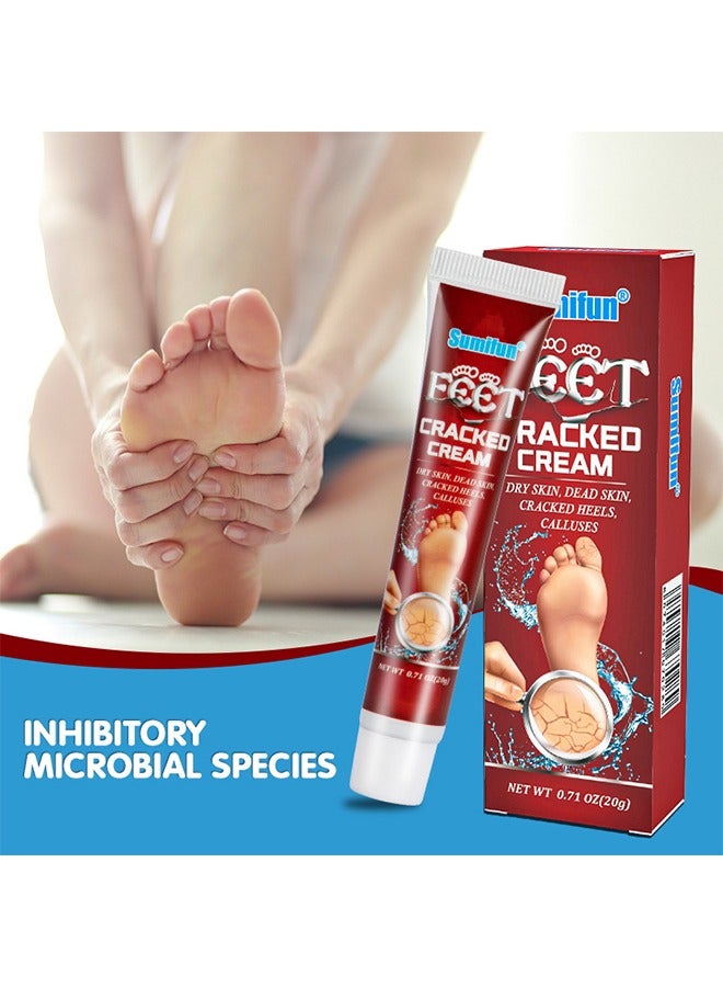 سوميفون كريم متصدع للقدمين ، كريم مرطب مضاد للتشقق للقدمين واليدين ، كريم مكثف لإصلاح القدم ، مرهم شفاء الجلد للكعب المتشقق والقدمين الجافة 20 جرام - Image 4