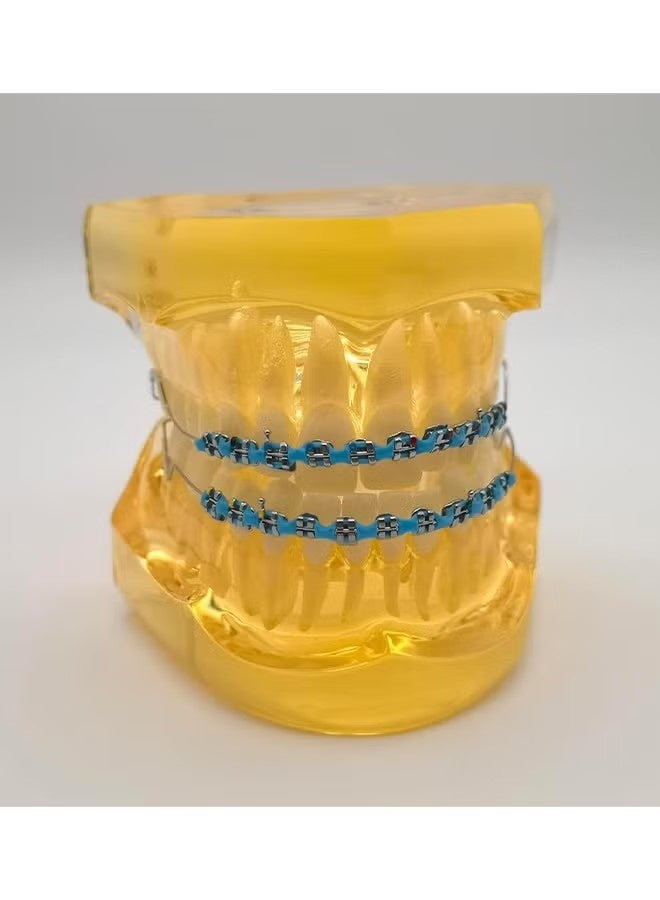 ATRJSZ Metal Braces For Orthodontics, Metal Bracket And Orthodontic Ligature Ties, Props For Dental Students Orthodontic Practice To Practice - Blue - Image 5