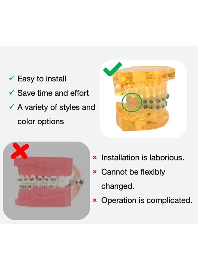 ATRJSZ Metal Braces For Orthodontics, Metal Bracket And Orthodontic Ligature Ties, Props For Dental Students Orthodontic Practice To Practice - Blue - Image 4