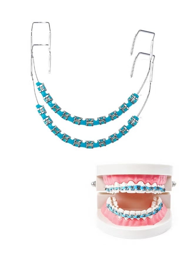 Metal Braces For Orthodontics, Metal Bracket And Orthodontic Ligature Ties, Props For Dental Students Orthodontic Practice To Practice - Blue