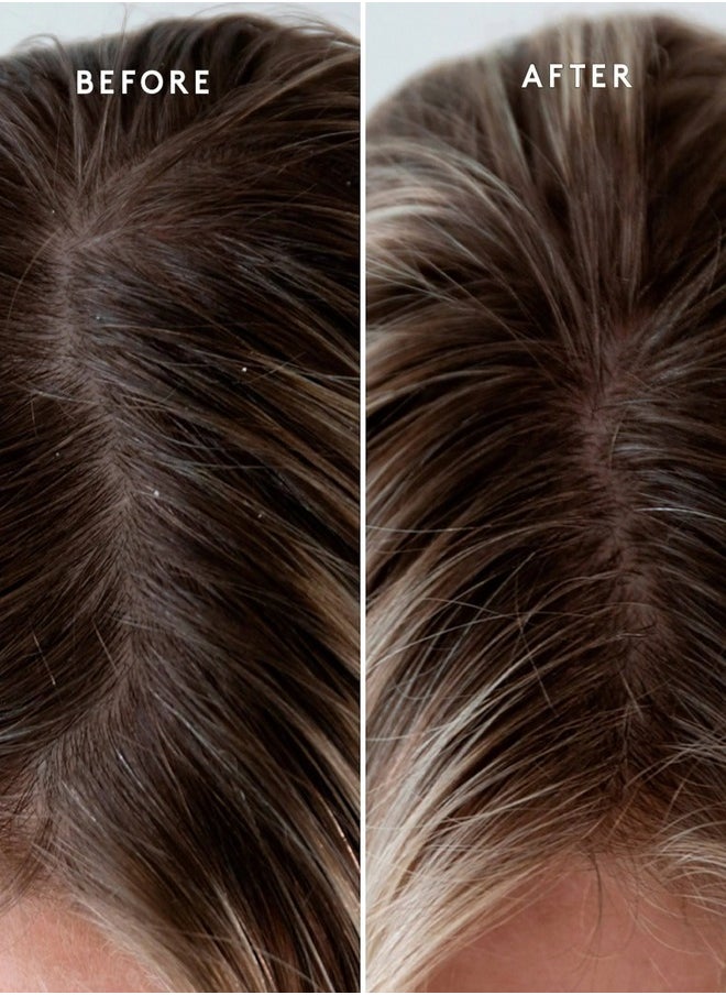 VIRTUE - VIRTUE Scalp Exfoliating Treatment 150ml – Detoxify & Revitalize Your Scalp - Image 1
