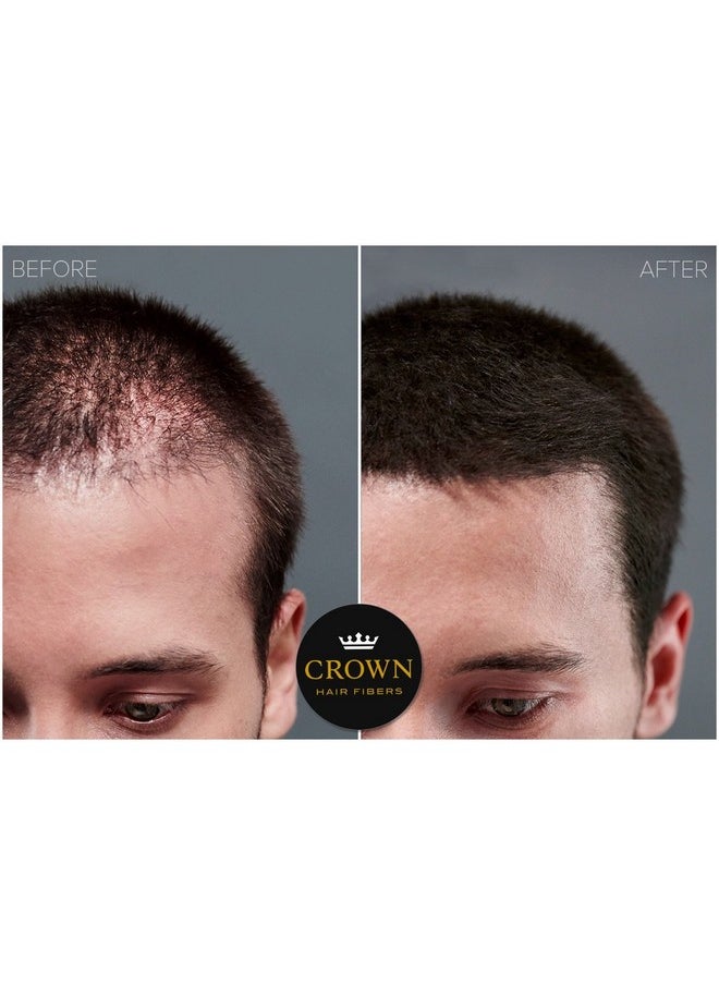 CROWN HAIR FIBERS - For Thinning Hair (Black) Instantly Thickens Thinning Or Balding Hair For Men & Women 0.87Oz/25G Bottle Best Natural Keratin Hair Loss Concealer - Image 1