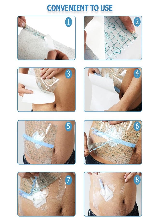 Mediss غطاء دش لقسطرة غسيل الكلى البريتوني من ميديس - ضمادة جروح شفافة، 8 بوصات × 8 بوصات، 50 قطعة - Image 5