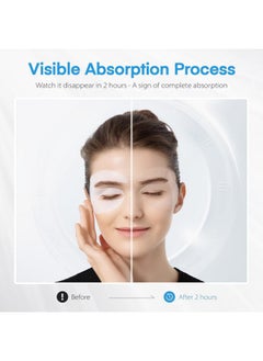 Dongyu Dongyu Collagen Under Eye Patches: Deep Real Collagen Overnight Eye Gels Mask With Caffeine Peptides Niacinamide - Dark Circles Puffiness Wrinkles Improvement - Neck Smile Line Pads - 8 Pairs  - Image 3
