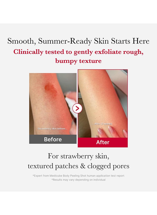 Red Body Peeling Shot – Exfoliating Spray Cleanser for Strawberry Skin with AHA, BHA & Succinic Acid