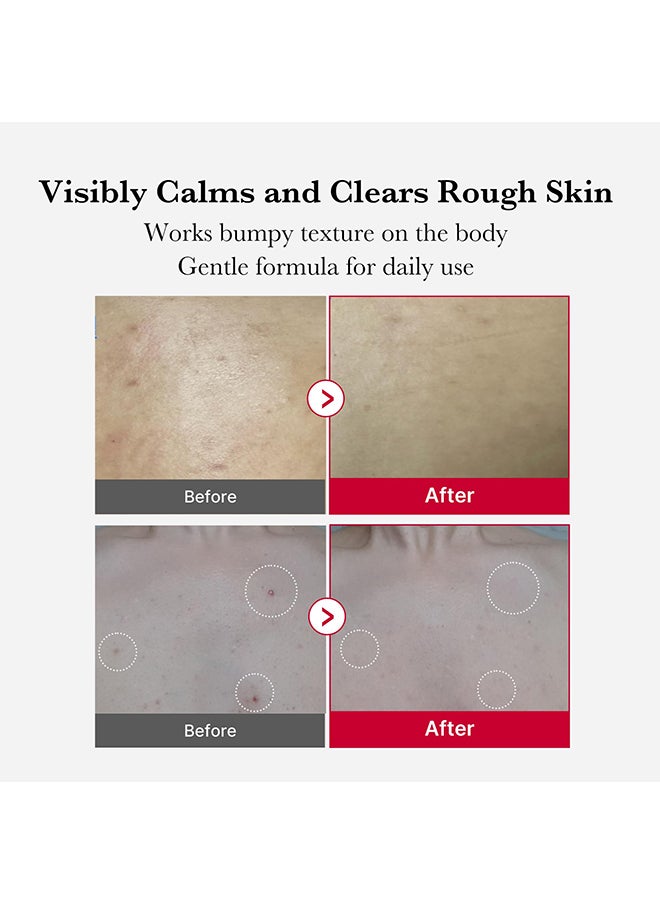 Red Body Peeling Shot – Exfoliating Spray Cleanser for Strawberry Skin with AHA, BHA & Succinic Acid