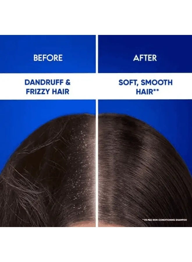 شامبو وبلسم 2 في 1 مضاد للقشرة وتساقط الشعر - Image 3