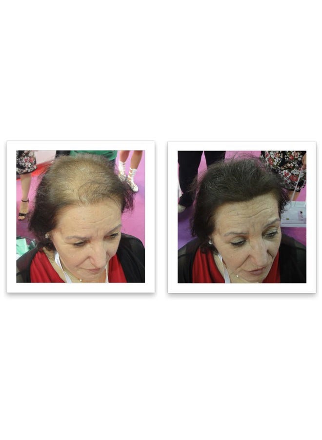 Caboki Hair Building Fiber 25g - Dark Brown - 3 X Value Triple Pack - Image 3