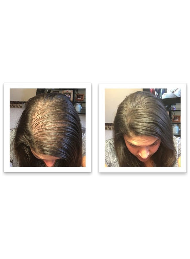 Caboki Hair Building Fiber 25g - Dark Brown - 3 X Value Triple Pack - Image 5