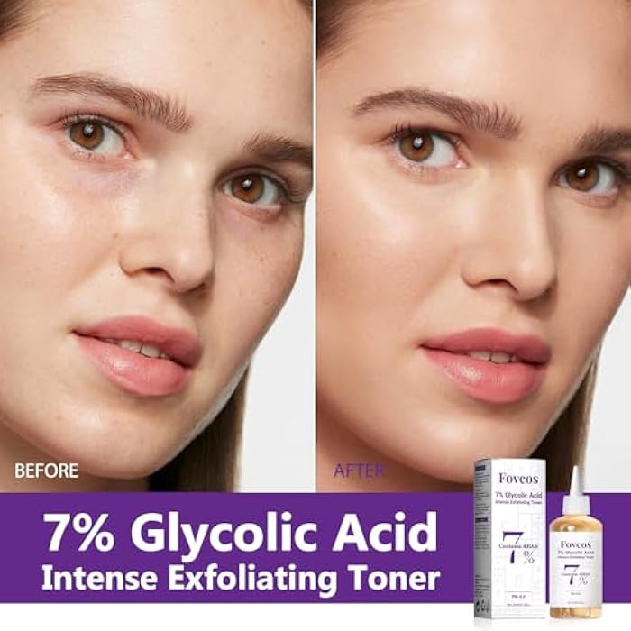 Fovcos 7% Glycolic Acid Exfoliating Toner, Exfoliating Skin Care Facial Toner, Improves Texture, Reduces Breakouts Pores and Fine Lines, Suitable for All Skin Types - Image 4