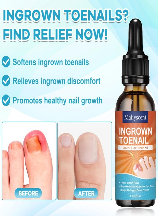 Maliyscent Ingrown Toenail Drop - Ingrown Toenail Pain Reliever and Softener Kit for Men Women Ingrown Toenail Corrector Drops - Image 3