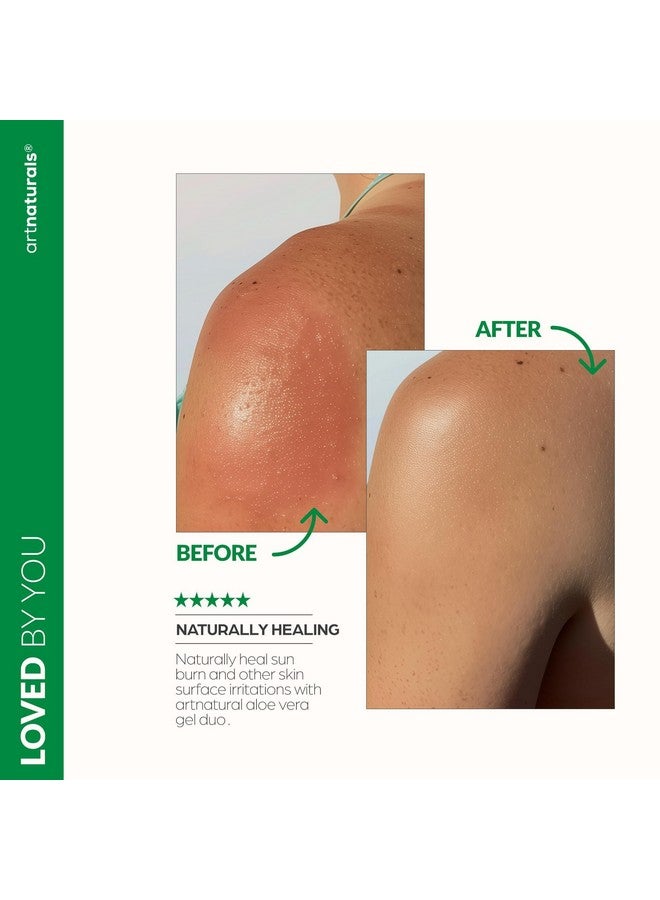 artnaturals Aloe Vera Gel Set - JUMBO 20oz (99% Pure Organic) - Sunburn Relief & Hydration for Face, Body, Scalp & Hair - Calming Moisturizer After Sun Exposure - Freshly Harvested within 12 Hours - Image 5