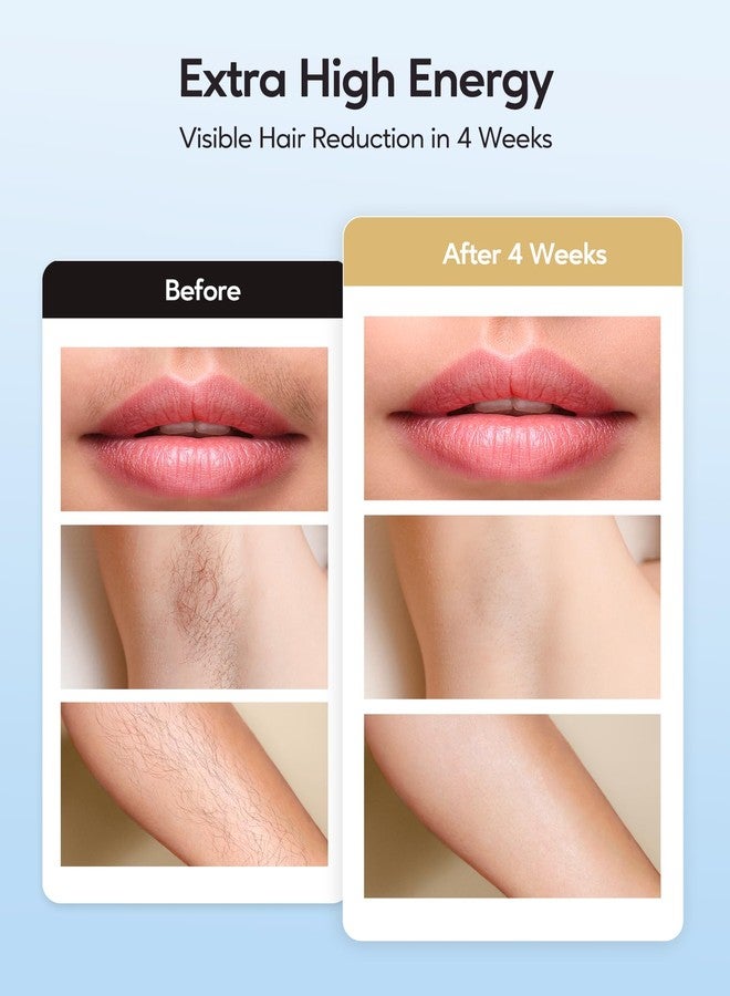 INNZA IPL Hair Removal with Ice Cooling Care Function for Women,Long-Lasting Results,999,999 Flashes Painless Hair Removal, Hair Removal Device for Armpits Legs Arms Bikini Line,Corded - Image 3