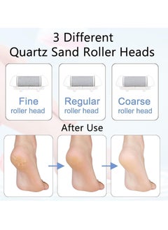 General Electric Callus Remover for Feet, Rechargeable Pedicure Tools Foot Care Feet File, 13 in 1 Callous Remover Kit for Remove Cracked Heels and Dead Skin, with 3 Roller Heads 2 Speed, Battery Display  - Image 4