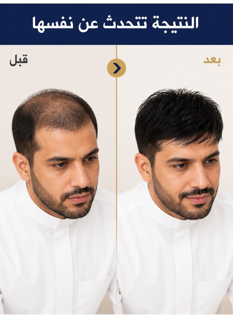 Natural Black Human Hair Toupee for Men - Premium Seamless Adhesive Hair System Replacement Wig - Image 2