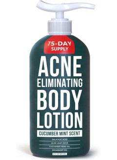 TreeActiv Acne Eliminating Body Lotion Cucumber Mint Scent 8fl oz 237ml  - Image 1