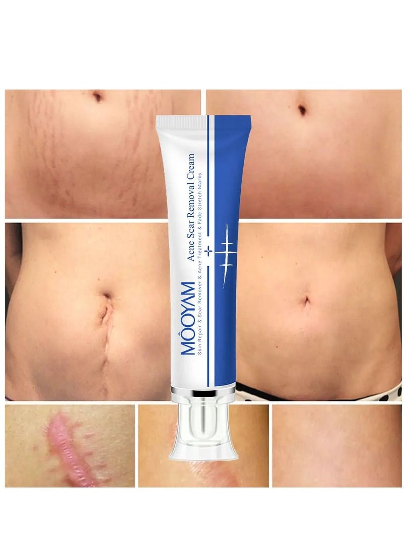 MOOYAM - Scar Removal Cream Acne Scar Cream Rapid Repair Scar Cream for Acne Surgery Injury Burns Advanced Gel Acne Scar Spot Treatment Suitable for All Skin Types 30g - Image 1