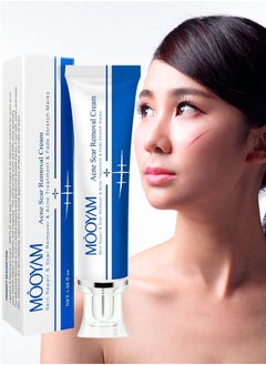 Scar Removal Cream Acne Scar Cream Rapid Repair Scar Cream for Acne Surgery Injury Burns Advanced Gel Acne Scar Spot Treatment Suitable for All Skin Types 30g