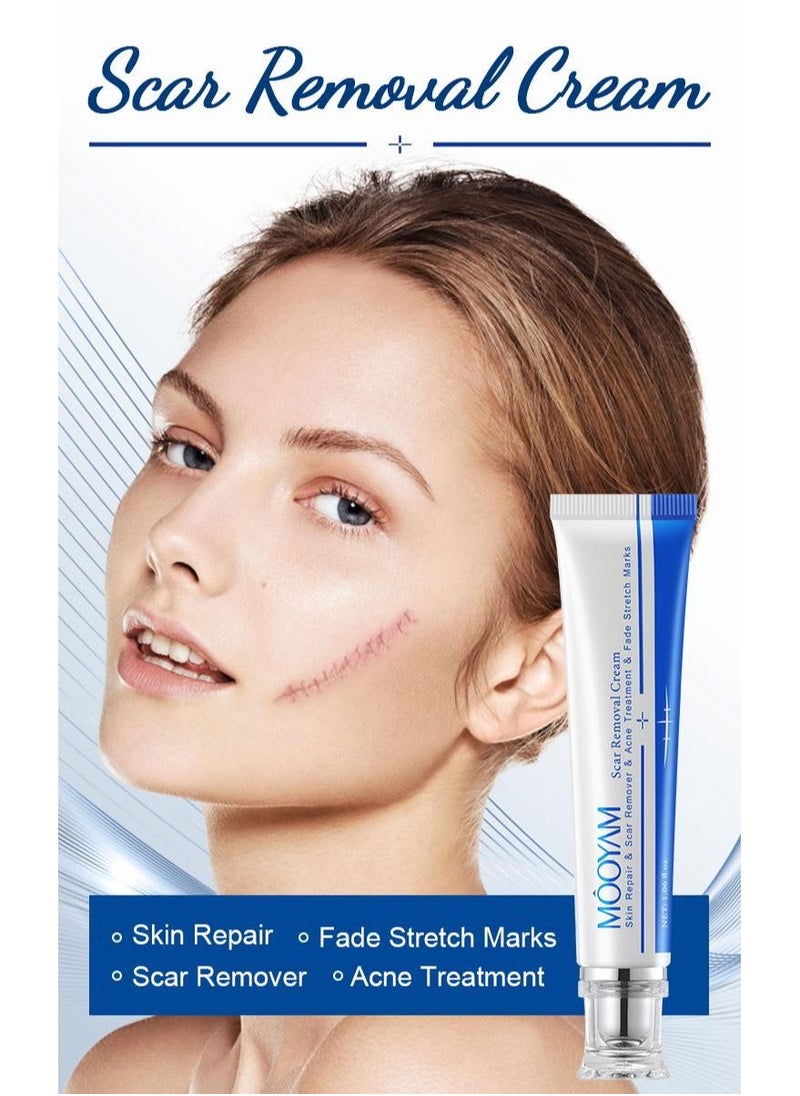 MOOYAM - Scar Removal Cream Acne Scar Cream Rapid Repair Scar Cream for Acne Surgery Injury Burns Advanced Gel Acne Scar Spot Treatment Suitable for All Skin Types 30g - Image 1