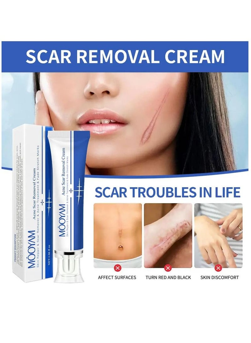 MOOYAM - Scar Removal Cream Acne Scar Cream Rapid Repair Scar Cream for Acne Surgery Injury Burns Advanced Gel Acne Scar Spot Treatment Suitable for All Skin Types 30g - Image 1
