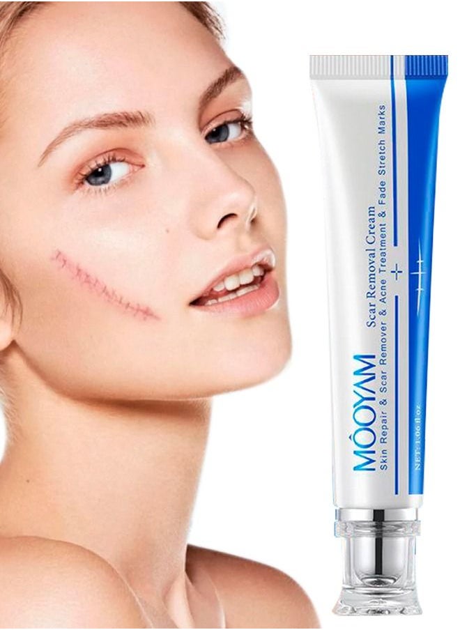 MOOYAM - Scar Removal Cream Acne Scar Cream Rapid Repair Scar Cream for Acne Surgery Injury Burns Advanced Gel Acne Scar Spot Treatment Suitable for All Skin Types 30g - Image 1