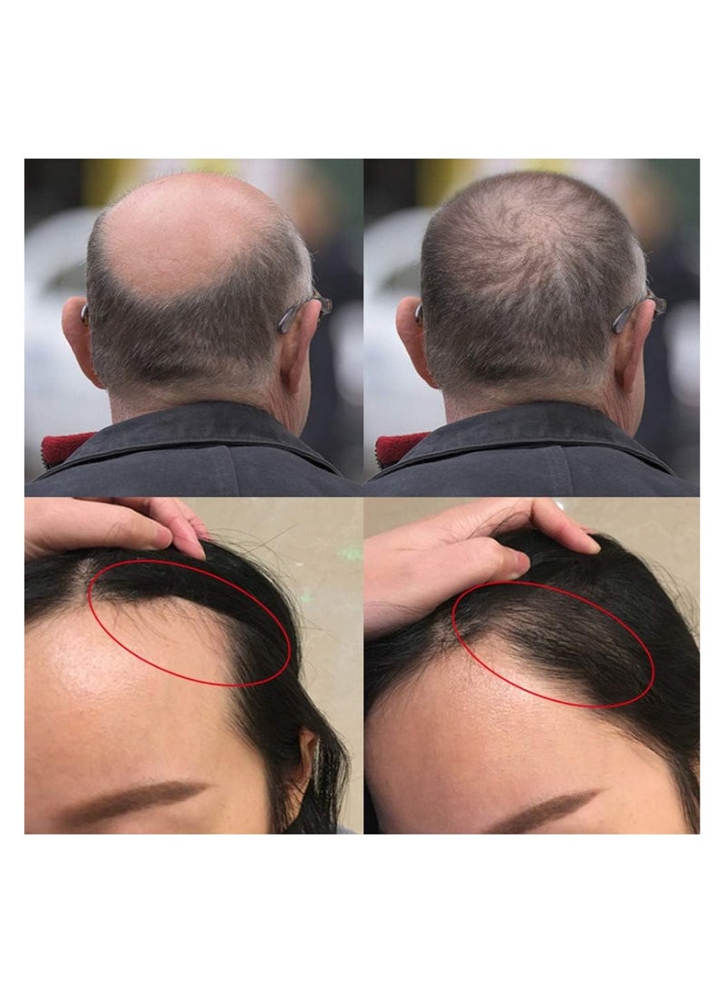 Caffeine - C1 Anti Hair Loss Essential Oil For Men & Women 30 ML - Image 1