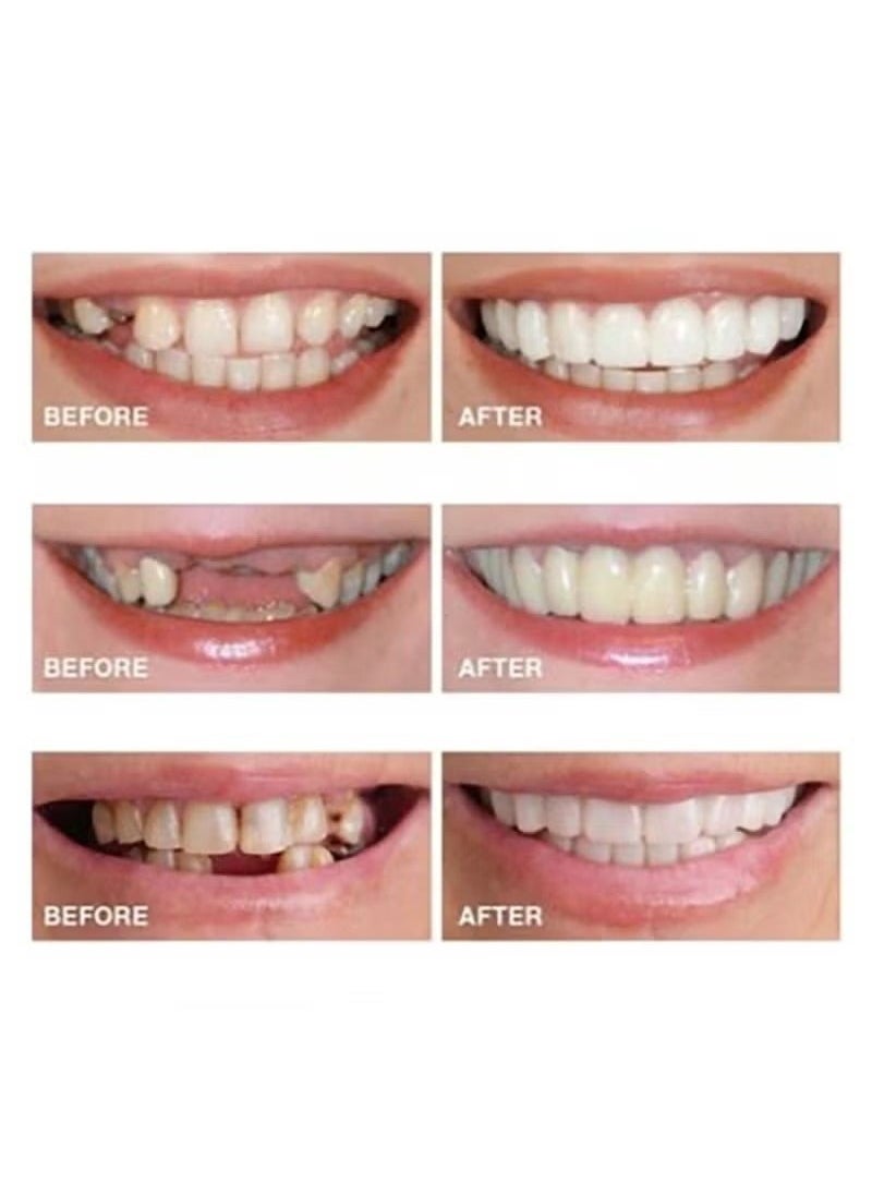 Tooth Repair Kits Customizable Temporary Denture Molds to Restore a Confident Smile