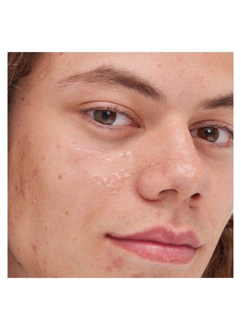 Inkey Beta Hydroxy Acid Serum - 30ml