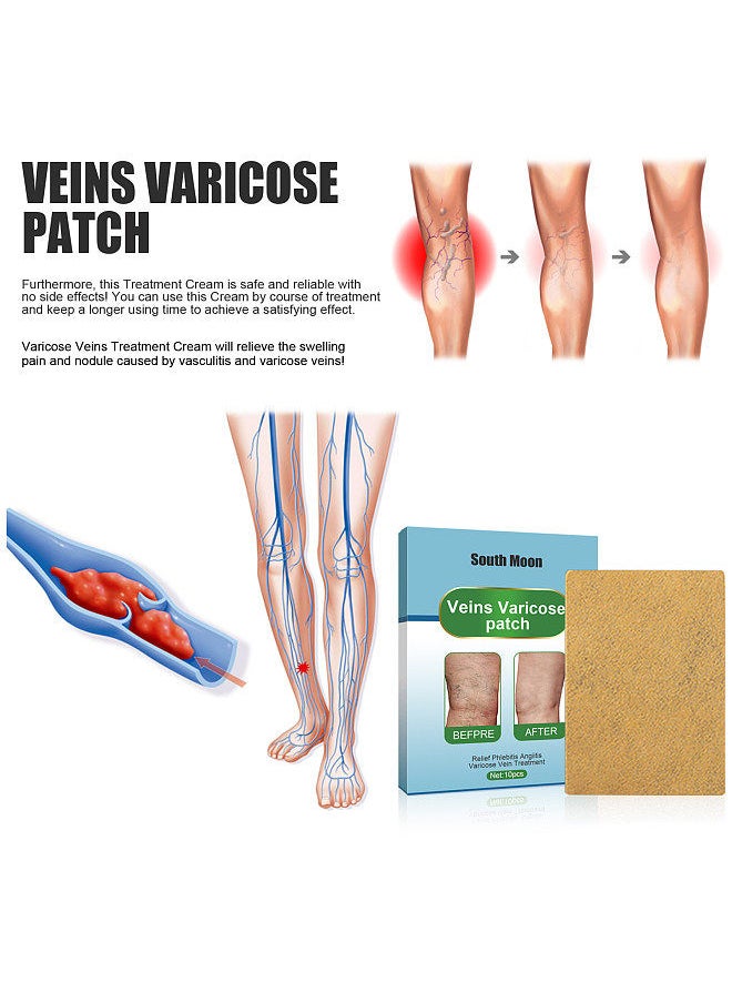 SOUTH MOON - South Moon 10Pcs Veins Varicose Patches Relieve Phlebitis Angiitis Improve Varicosity Soothing Leg Swelling Pain - Image 1