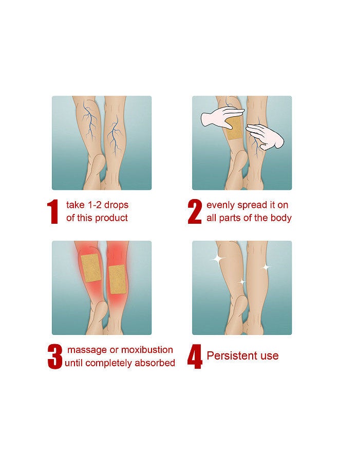 SOUTH MOON - South Moon 10Pcs Veins Varicose Patches Relieve Phlebitis Angiitis Improve Varicosity Soothing Leg Swelling Pain - Image 1
