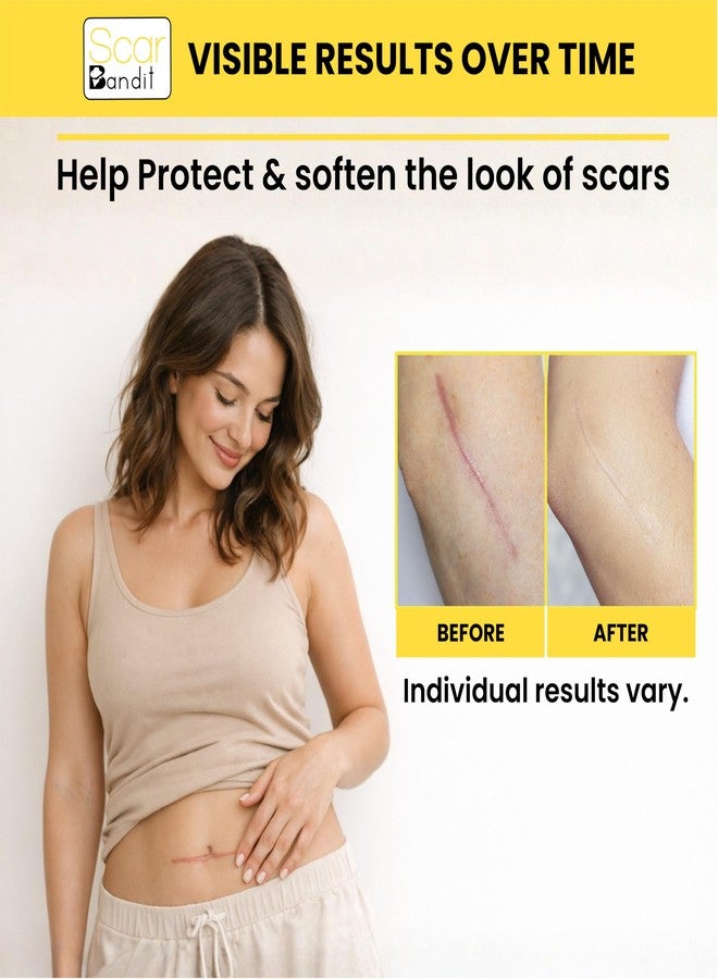 SCAR BANDIT ضمادات سيليكون سكار بانديت للندبات الناتجة عن الولادة القيصرية والجراحات - شريط سيليكون للندبات للتعافي بعد الولادة القيصرية، وشد البطن، والجراحة - ضمادات مرنة للندبات الجدرية والعناية بالندبات - 4 قطع - Image 5