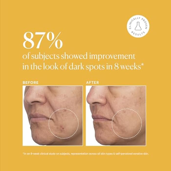 Naturium Tranexamic Topical Acid 5%, Face & Skin Care, with Kojic Acid, Niacinamide & Licorice Root, 1 oz - Image 5