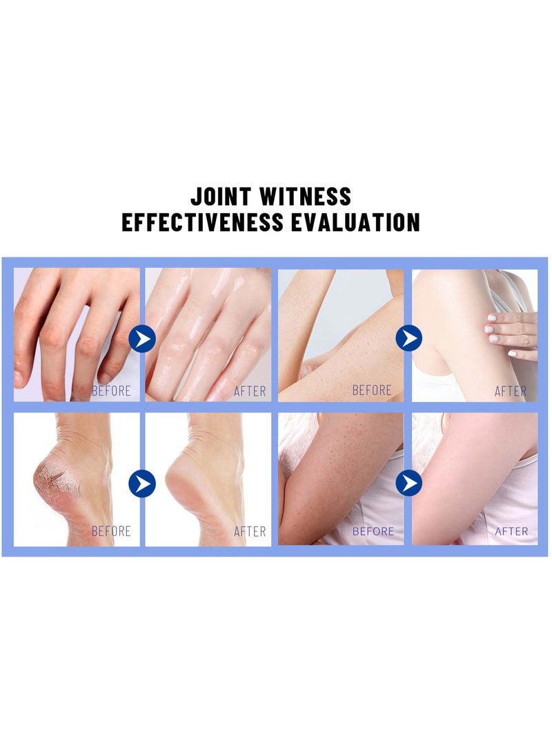 OUKEYA - Urea Cream, 40 Percent Cracked Heel Repair Balm Stick for Dry Cracked Feet Treatment Urea Hand Foot Moisturizing Cream for Dry Cracked Feet, for Feet Dead Skin Remover 30g - Image 1