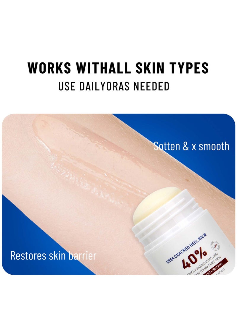 OUKEYA - Urea Cream, 40 Percent Cracked Heel Repair Balm Stick for Dry Cracked Feet Treatment Urea Hand Foot Moisturizing Cream for Dry Cracked Feet, for Feet Dead Skin Remover 30g - Image 1