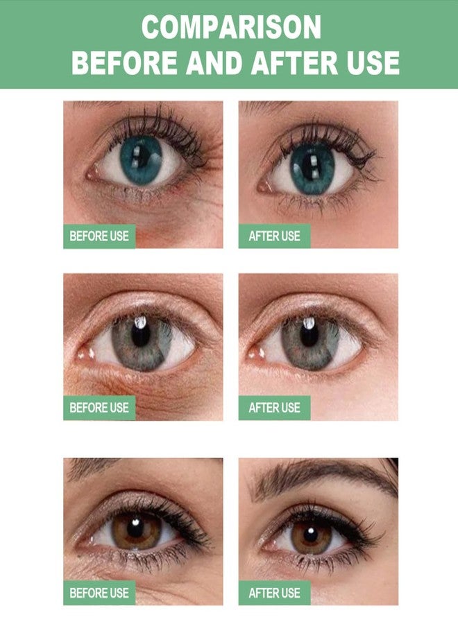 FirstFly 60 PCS Aloe Vera Eye Masks, Gel Collagen Under Eye Patches for Puffy Eyes and Dark Circles Treatments, Reduce Wrinkles and Fine Lines Undereye Patches - Image 4