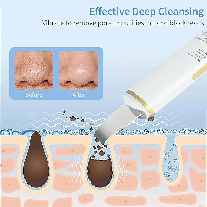 GUGUG Facial Skin Scrubber Ultrasonic Skin Spatula Face Blackhead Remover Scraper with Four Modes for Deep Cleansing Portable and Rechargeable Pore Scrubber Include 2 Silicone Covers - Image 3