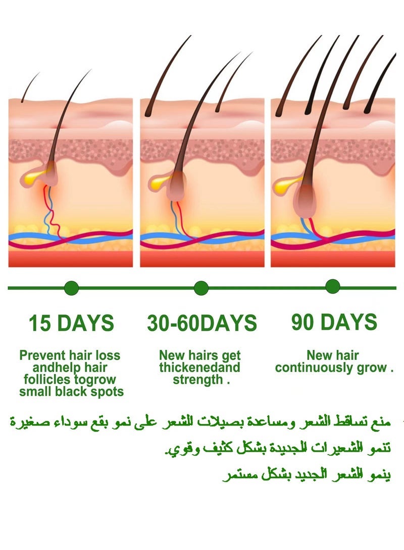 إيلهو زيوت إكليل الجبل الأساسية زيت إكليل الجبل لمصل نمو الشعر ، زيت إكليل الجبل العضوي النقي للشعر الجاف التالف والنمو ، تساقط الشعر ، علاج فروة الرأس ، العناية بالبشرة 1/4 للعناية بالشعر لنمو الشعر (30 مل) - Image 3