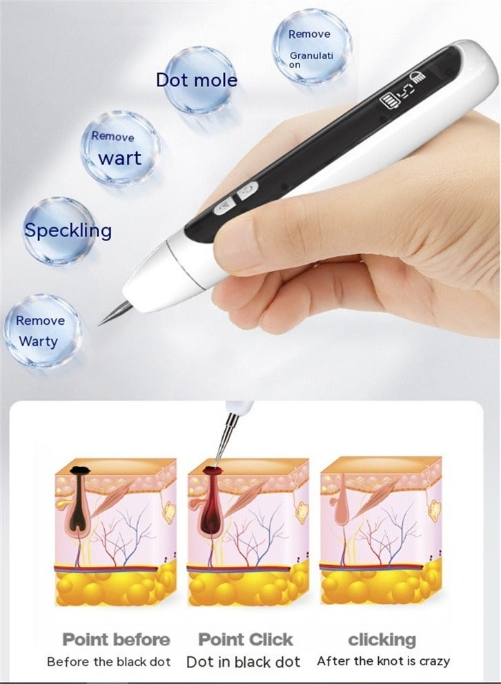 Generic Laser Mole Removal Pen, Portable Skin Tag Removal Pen for Face, Body Warts, Freckles, Mole Spot Treatment and Age Spots  - Image 2