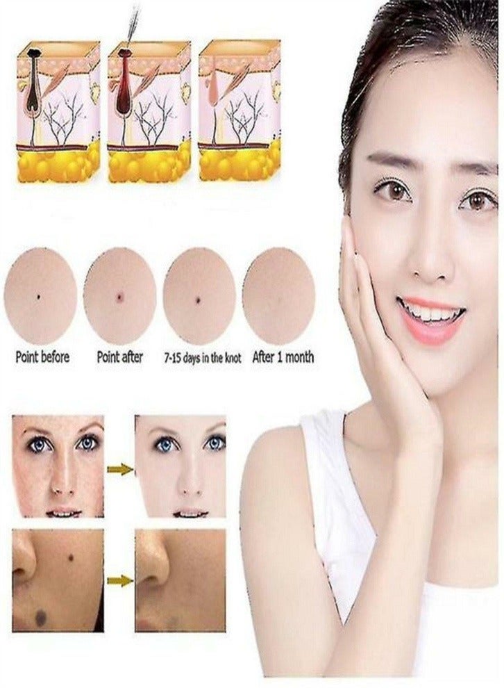 Generic Laser Mole Removal Pen, Portable Skin Tag Removal Pen for Face, Body Warts, Freckles, Mole Spot Treatment and Age Spots  - Image 3