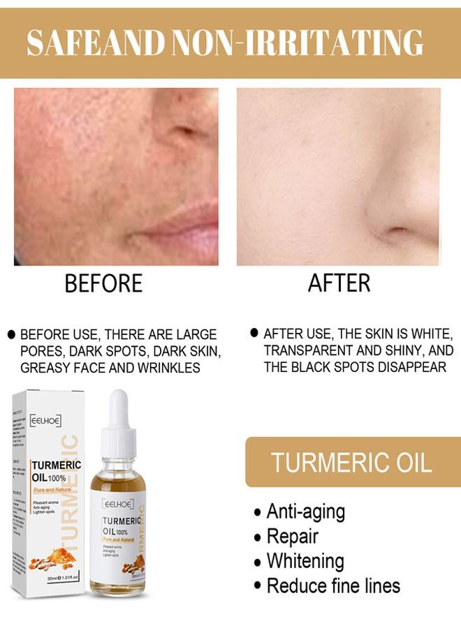 EELHOE Turmeric Oil 30ml, Pleasant Aroma, Anti-aging, Black Spot Removing and Lighten Spots - Image 4